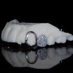 Iced Molar + Plain Canine Both Sides