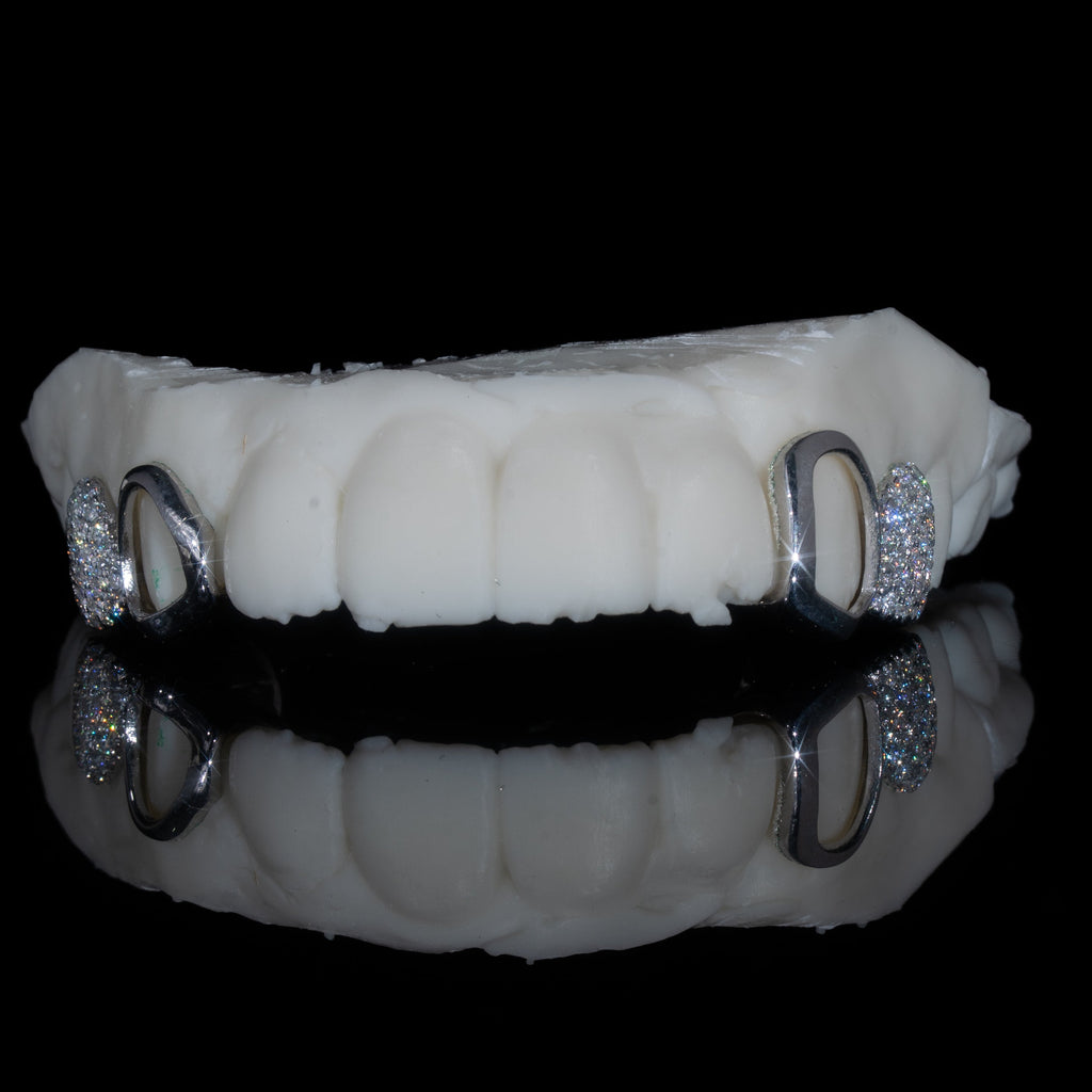 Iced Molar + Plain Canine Both Sides