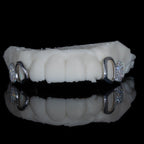 Iced Molar + Plain Canine Both Sides