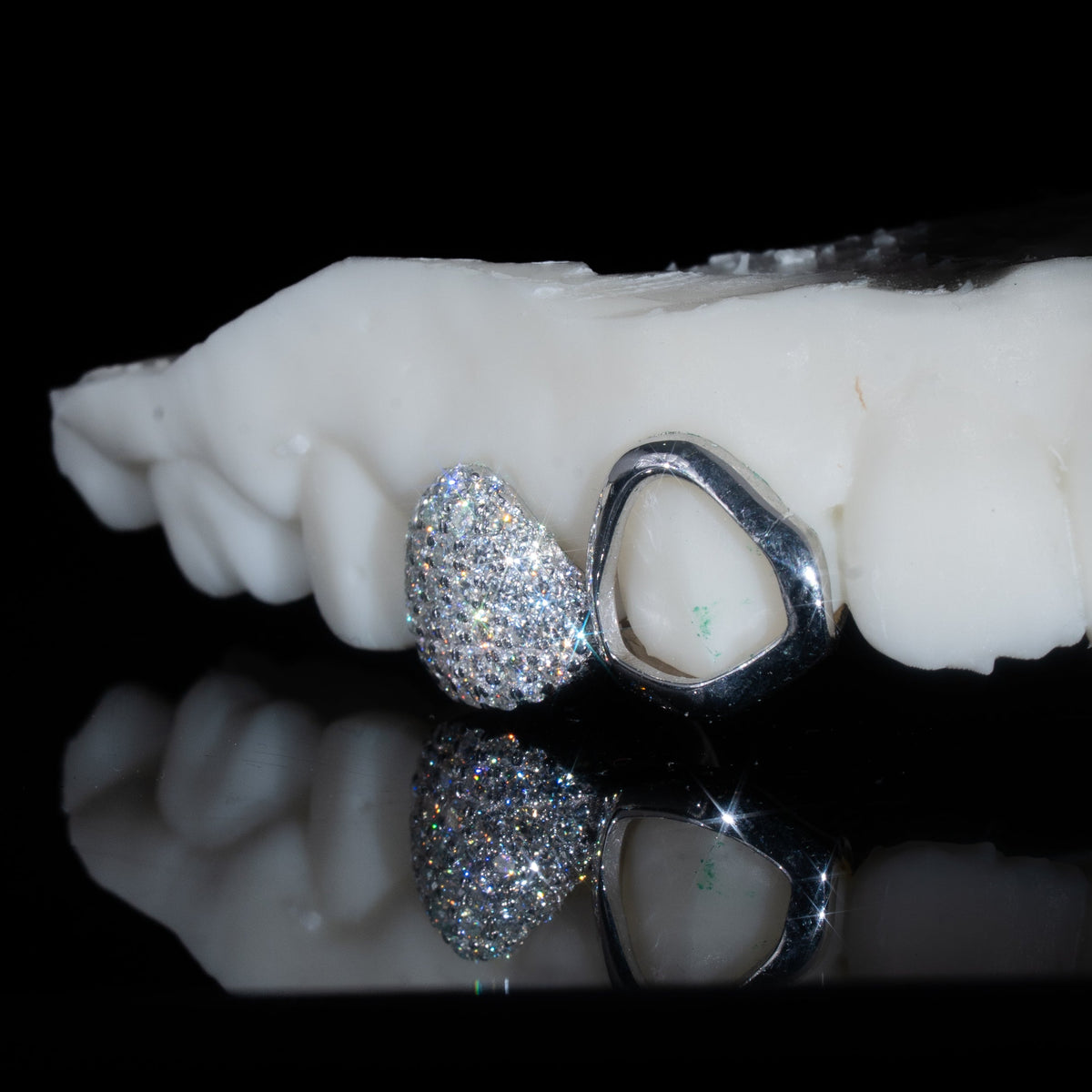 Iced Molar + Plain Canine Both Sides