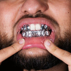 Double Molar Set + Bottom 8 Frost Cut