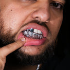 Double Molar Set + Bottom 8 Frost Cut